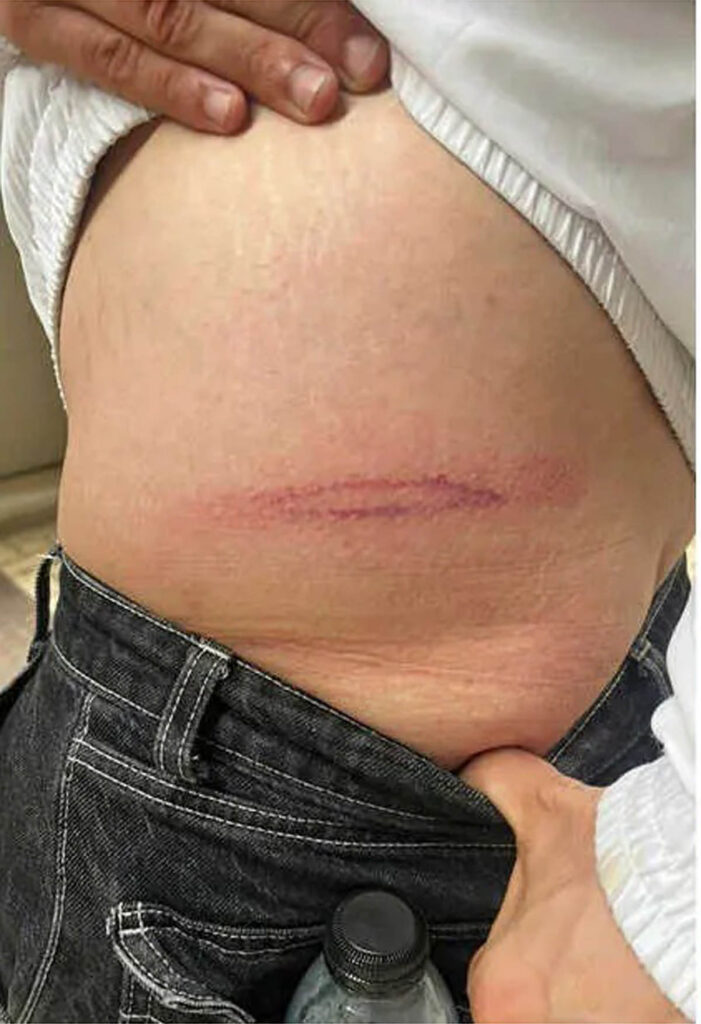 Demostracion-de-lo-que-saben-hacer-las-fuerzas-represivas-del-estado-a-quien reclama-derechos-democraticos